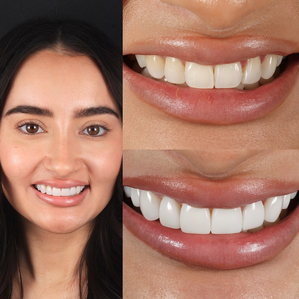 Ringway Dental - Cheadle - Cosmetic and Implant Dentistry — Dental Clinic in Manchester