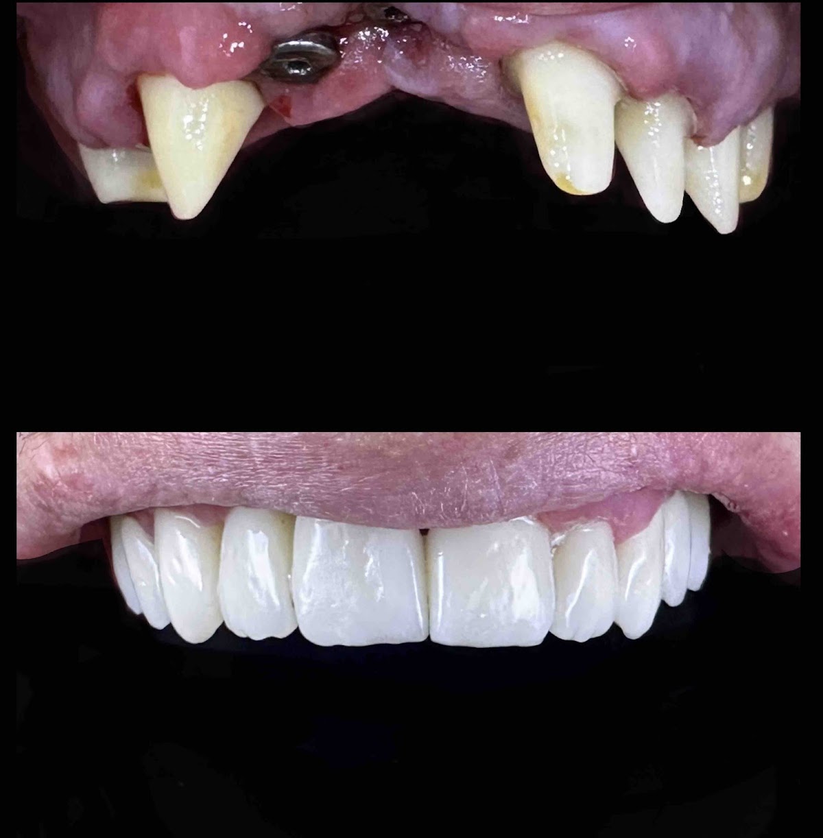 Dental Tourism Macedonia - Dental clinic in Skopje, North Macedonia