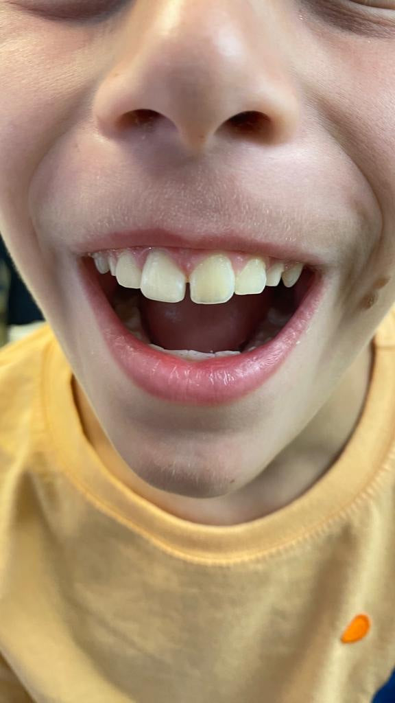 Dental Bodrum | Diş Hekimi | Ağız ve Diş Sağlığı | Estetik Diş Hekimliği | Gülüş Tasarımı — Dr.Visor photo 4