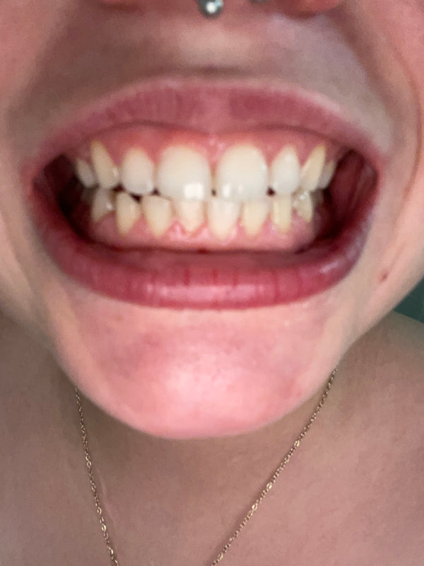 Ross Tracey B DDS | Dental | Covington, KY