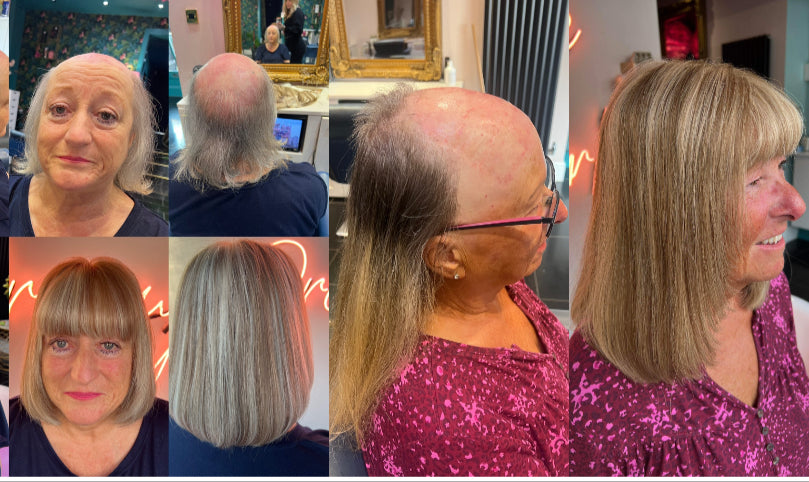 Dreamgirlz Hair Extensions and Hair Replacement Experts - Hair Transplant clinic in Newcastle upon Tyne, United Kingdom