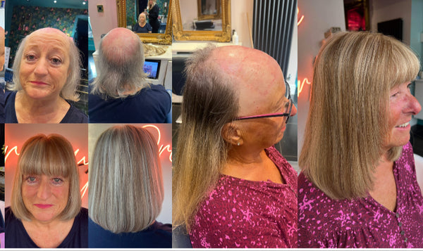 Dreamgirlz Hair Extensions and Hair Replacement Experts | Hair Transplant | Newcastle upon Tyne