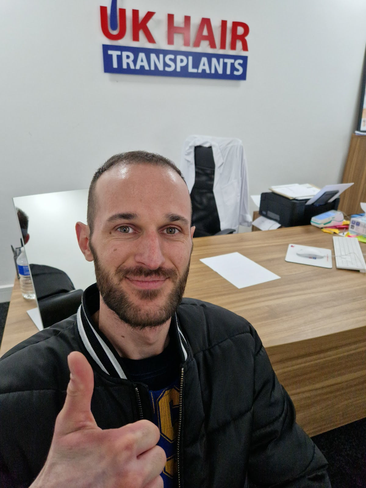 UK Hair Transplants UKHT Walsall — photo 4