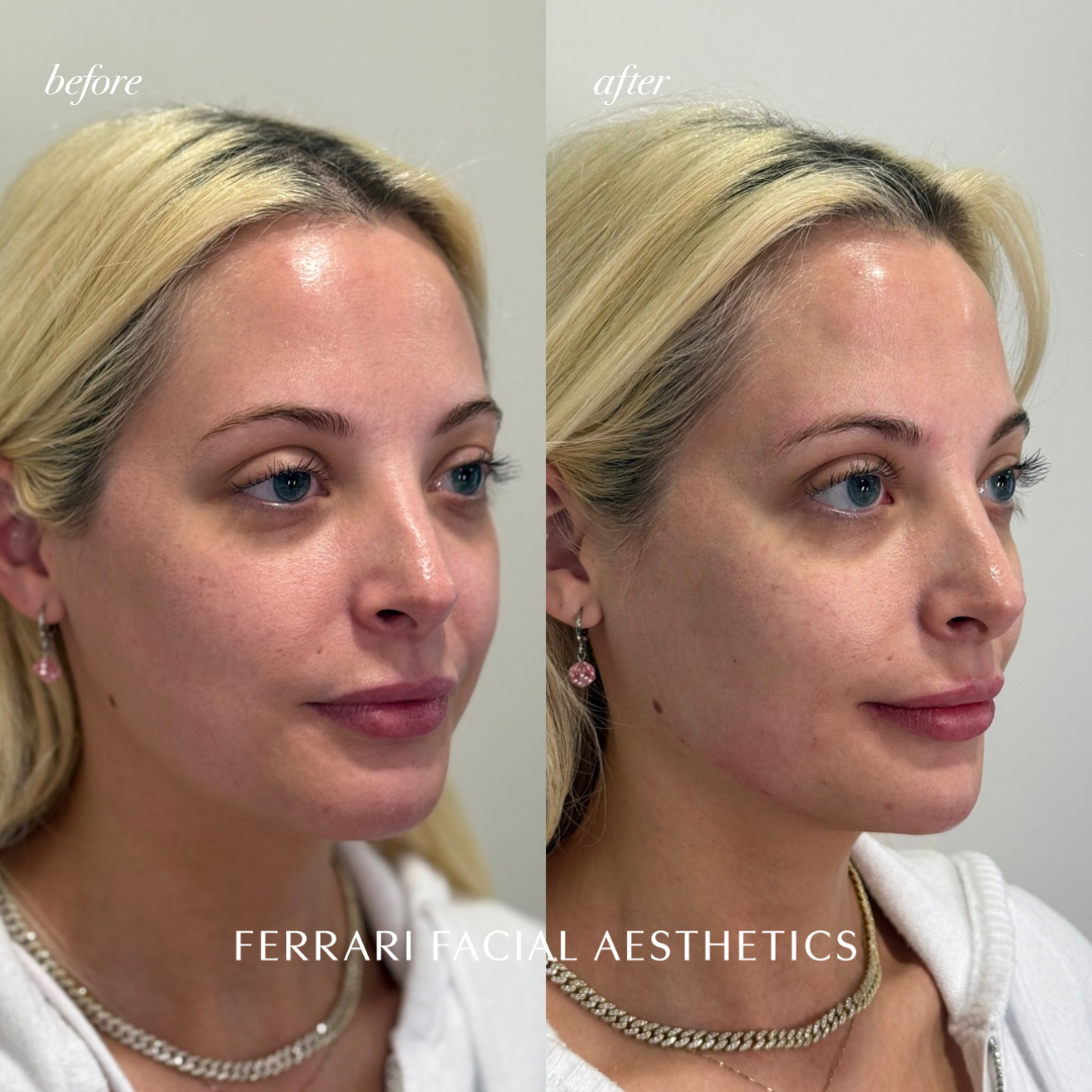 Ferrari Facial Aesthetics | Aesthetic Surgery | Charleston, WV