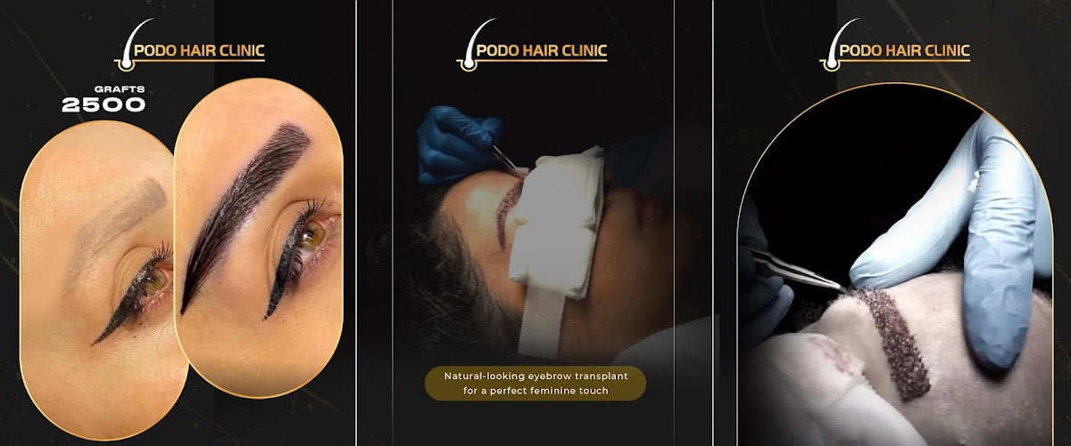 PODO HAIR CLINIC - Hair Transplant clinic in Köln, Germany