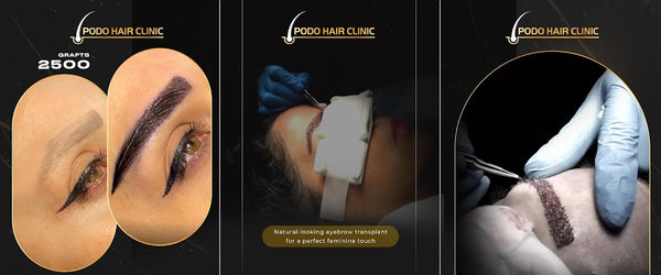 PODO HAIR CLINIC | Hair Transplant | Köln