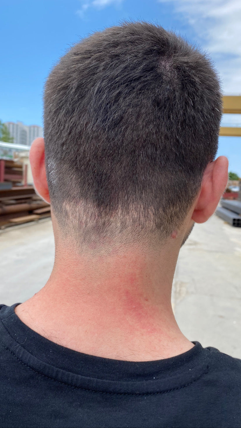 ANATOLIA HAIR TRANSPLANT - YELİZ DAMAR — Dr.Visor photo 5