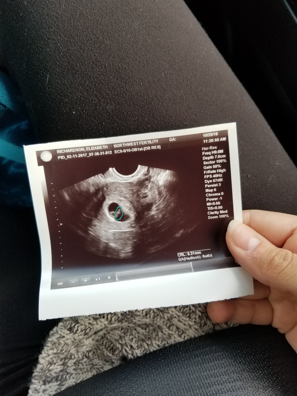 Northwest Fertility Center | IVF | Portland, OR
