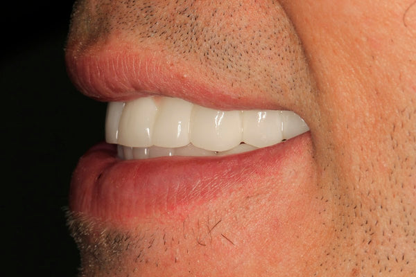 Dr. Aaron M. Shearman | Dental | Butte, MT