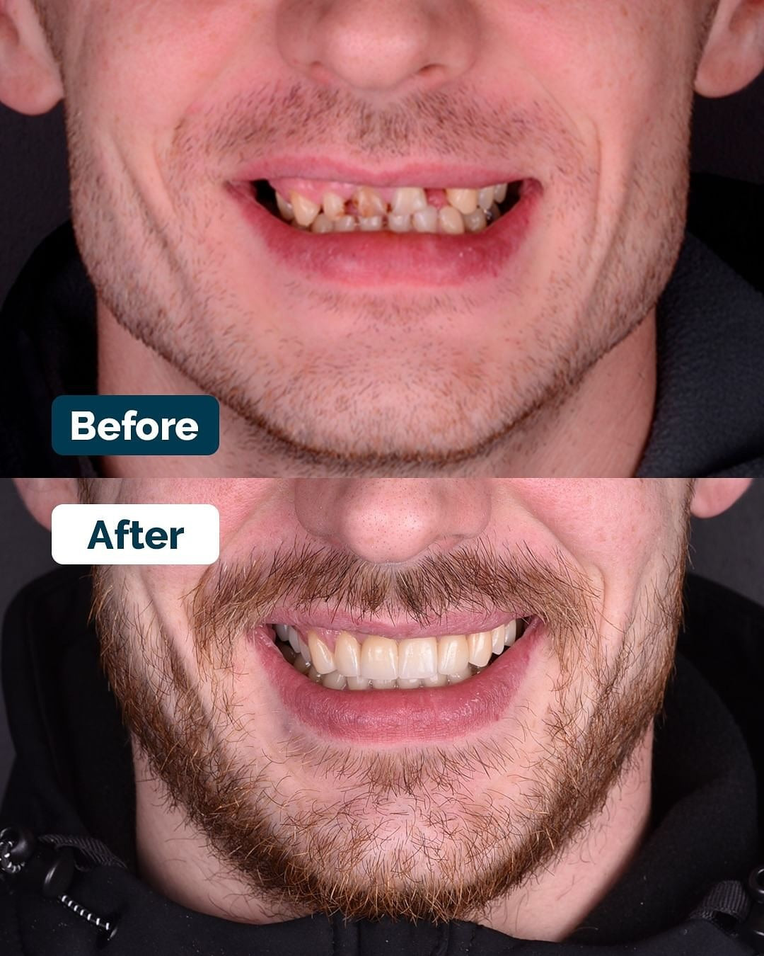 RiT Dental Care | Dental Clinic in Birmingham | Implants, Orthodontics and Cosmetic Dentistry — photo 3