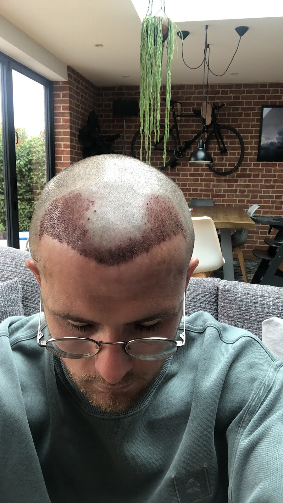 Capital Hair Restoration — Dr.Visor photo 5