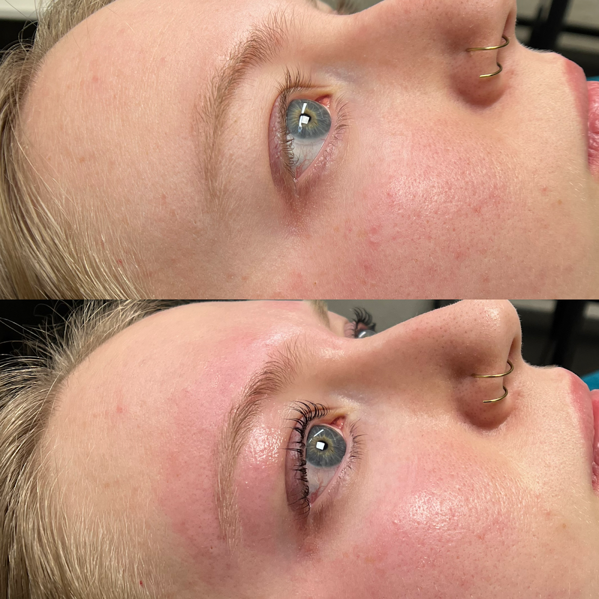 Sech Aesthetics | Aesthetic Surgery | Lawton, OK