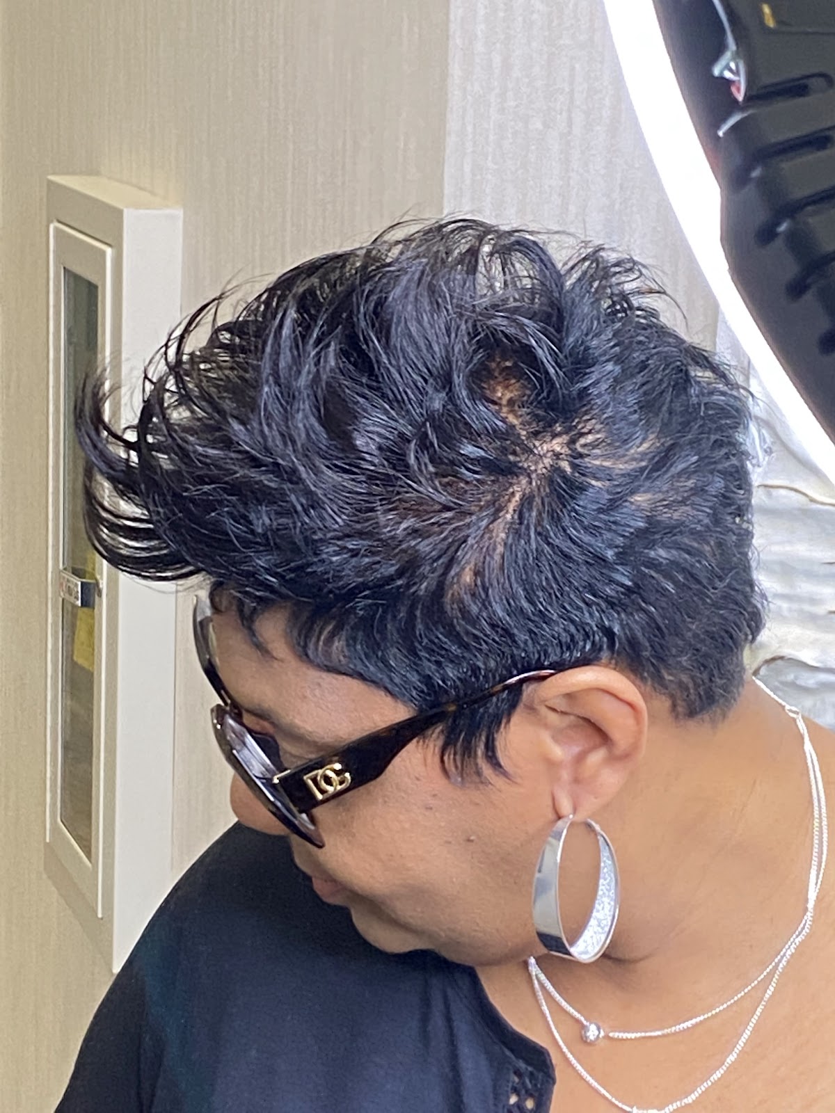 Hair Care Solutions By Kilikis LLC | Hair Transplant | Gladstone, MO