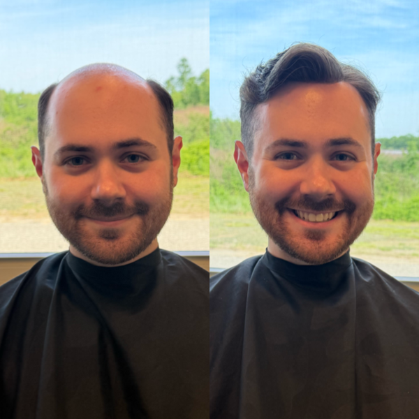 Madeline's Hair Replacement | Hair Transplant | Saco, ME