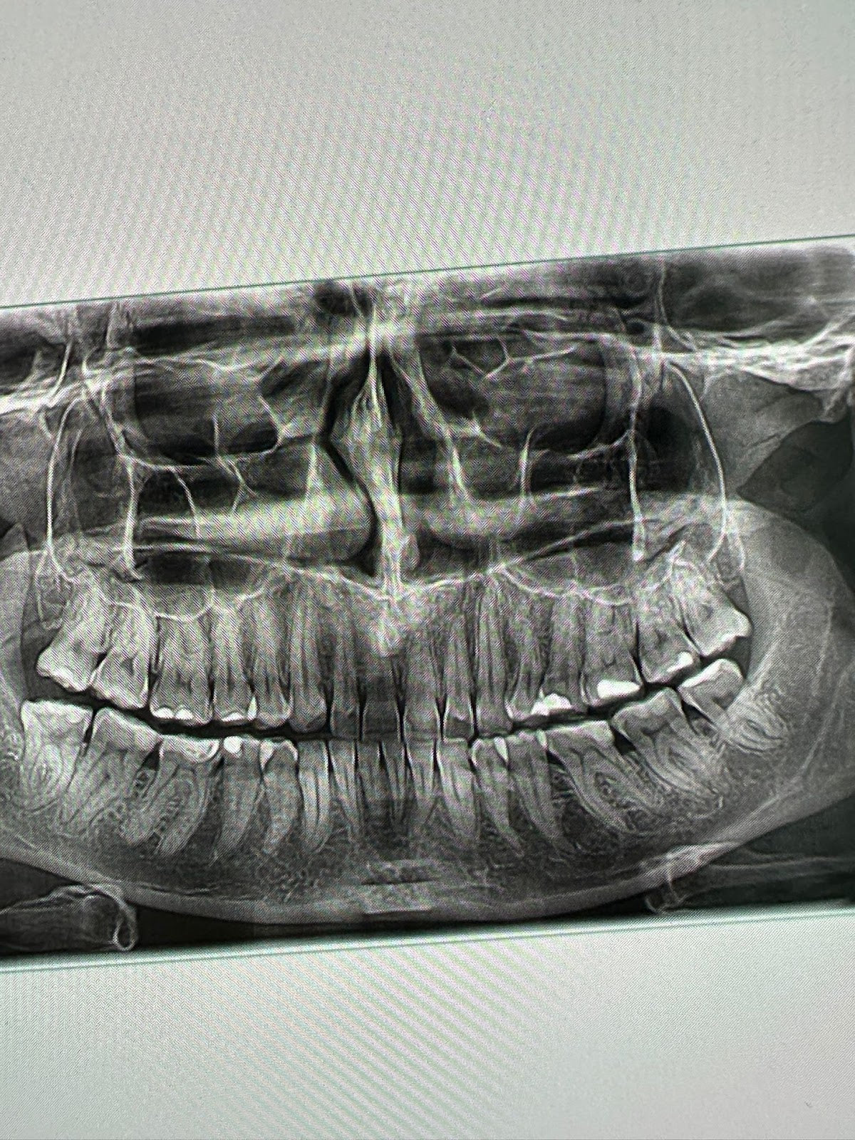 Pro Dental Centar - Dental clinic in Beograd, Serbia