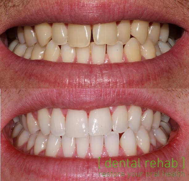 Newcastle Dental Implant Centre | Newcastle Advanced Dentistry — photo 4