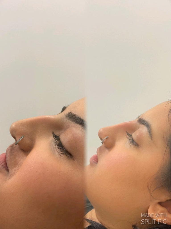 AG Clinic | Aesthetic Surgery | Birmingham