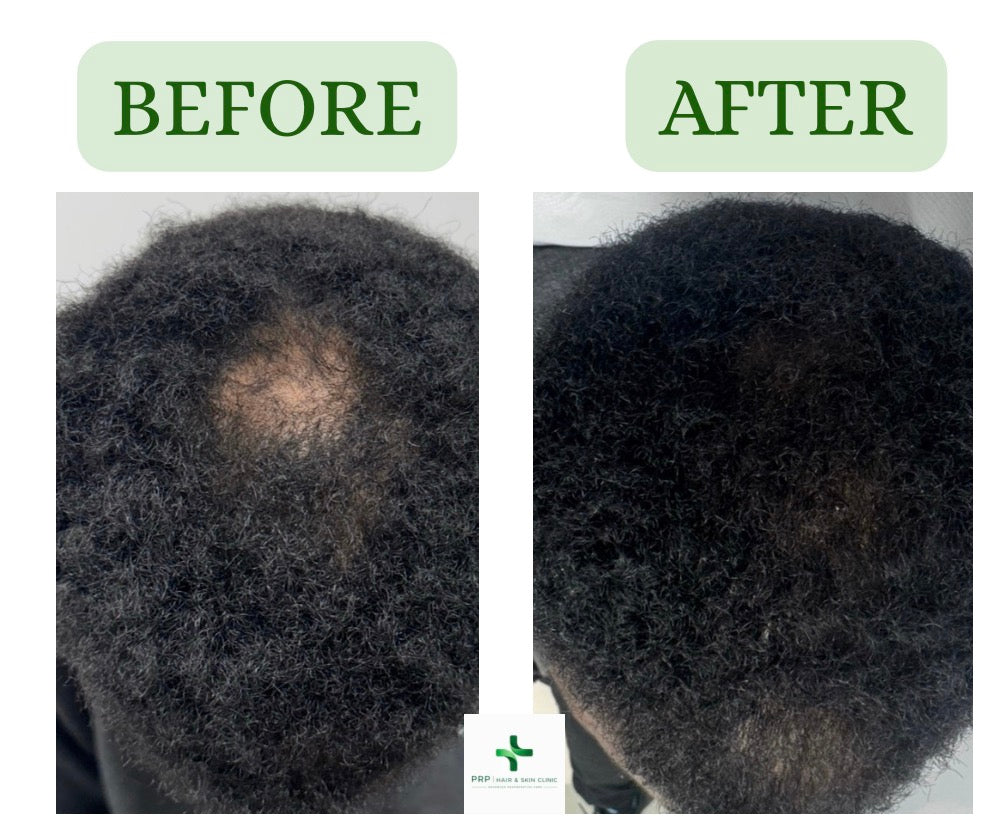 PRP Hair And Skin Clinic — photo 5