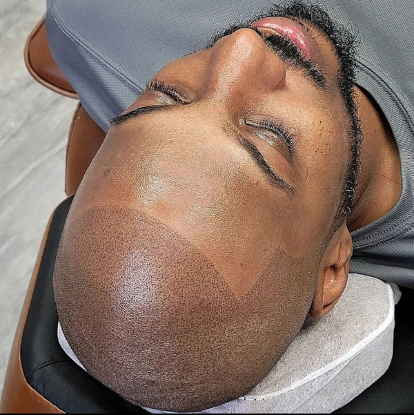 Elysian SMP Hair Restoration | Hair Transplant | Bellevue, NE