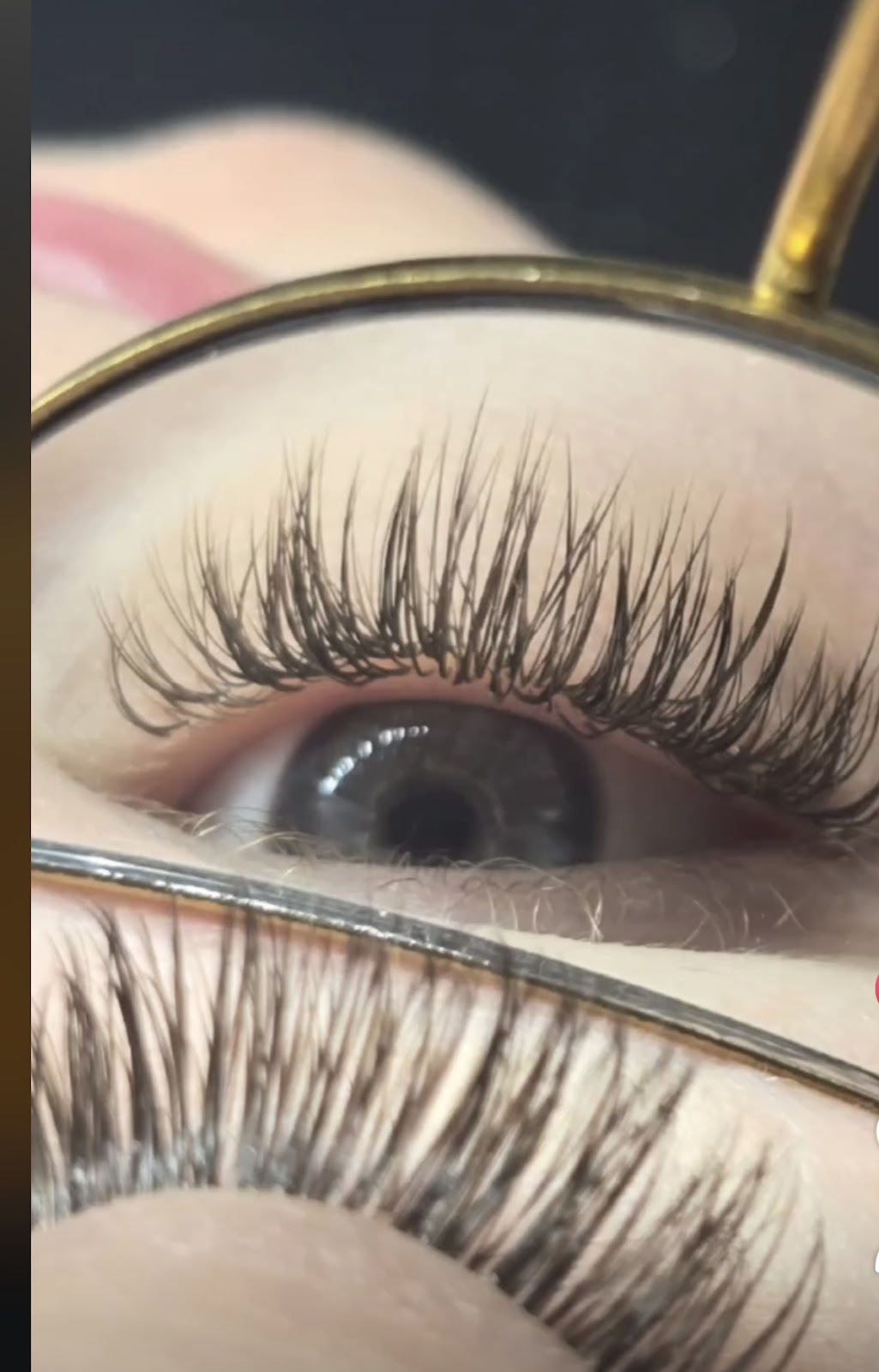 Stellar Luxury Aesthetics | Hair Transplant | Rock Springs, WY