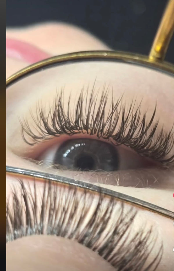 Stellar Luxury Aesthetics | Hair Transplant | Rock Springs, WY