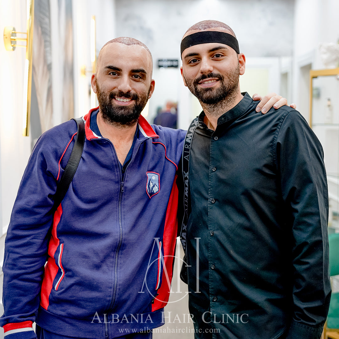 Trapianto Di Capelli | Albania Hair Clinic - Hair Transplant clinic in Tiranë, Albania