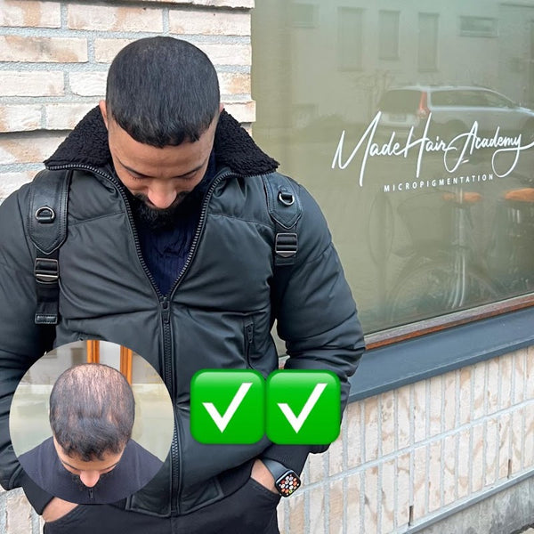 Made Hair Academy Göteborg Scalp Micropigmentation | Hair Transplant | 417 23 Göteborg
