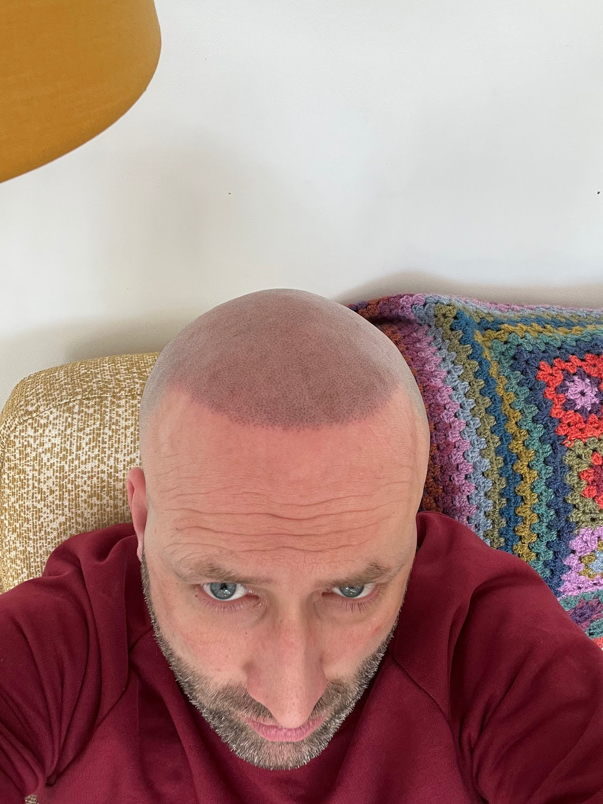 HIS Hair Clinic — photo 2