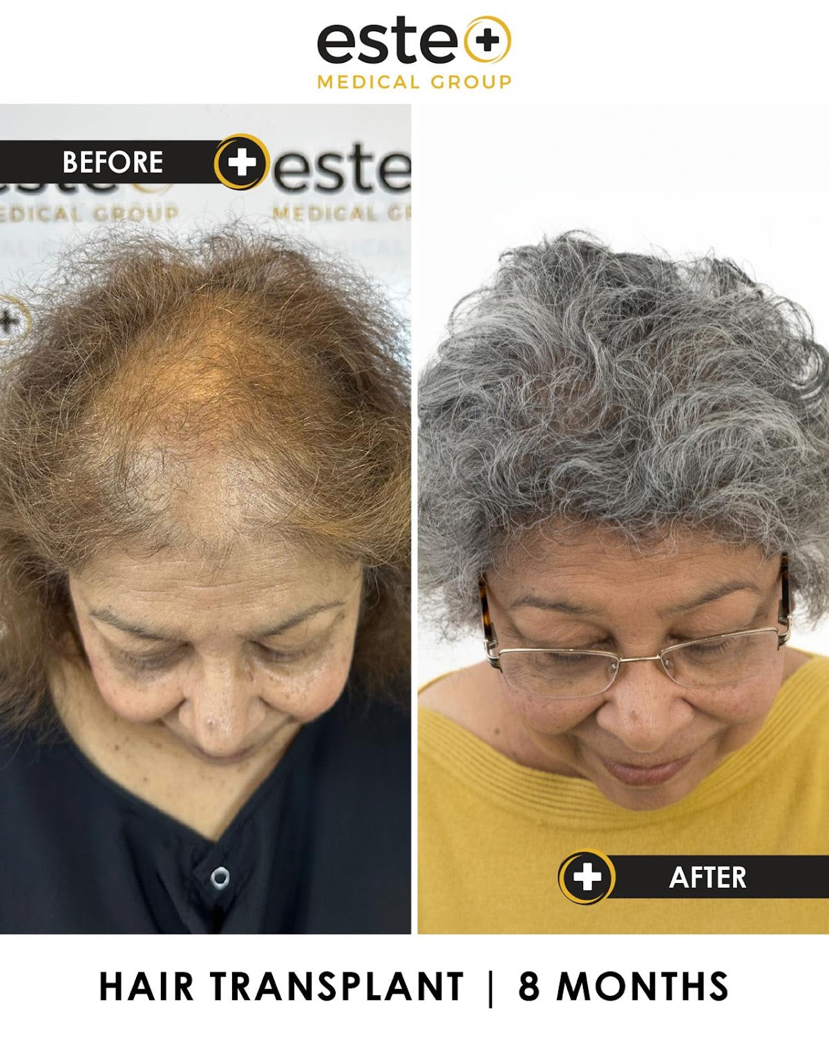 Este Medical Group Hair & Skin Clinic Leeds — photo 2