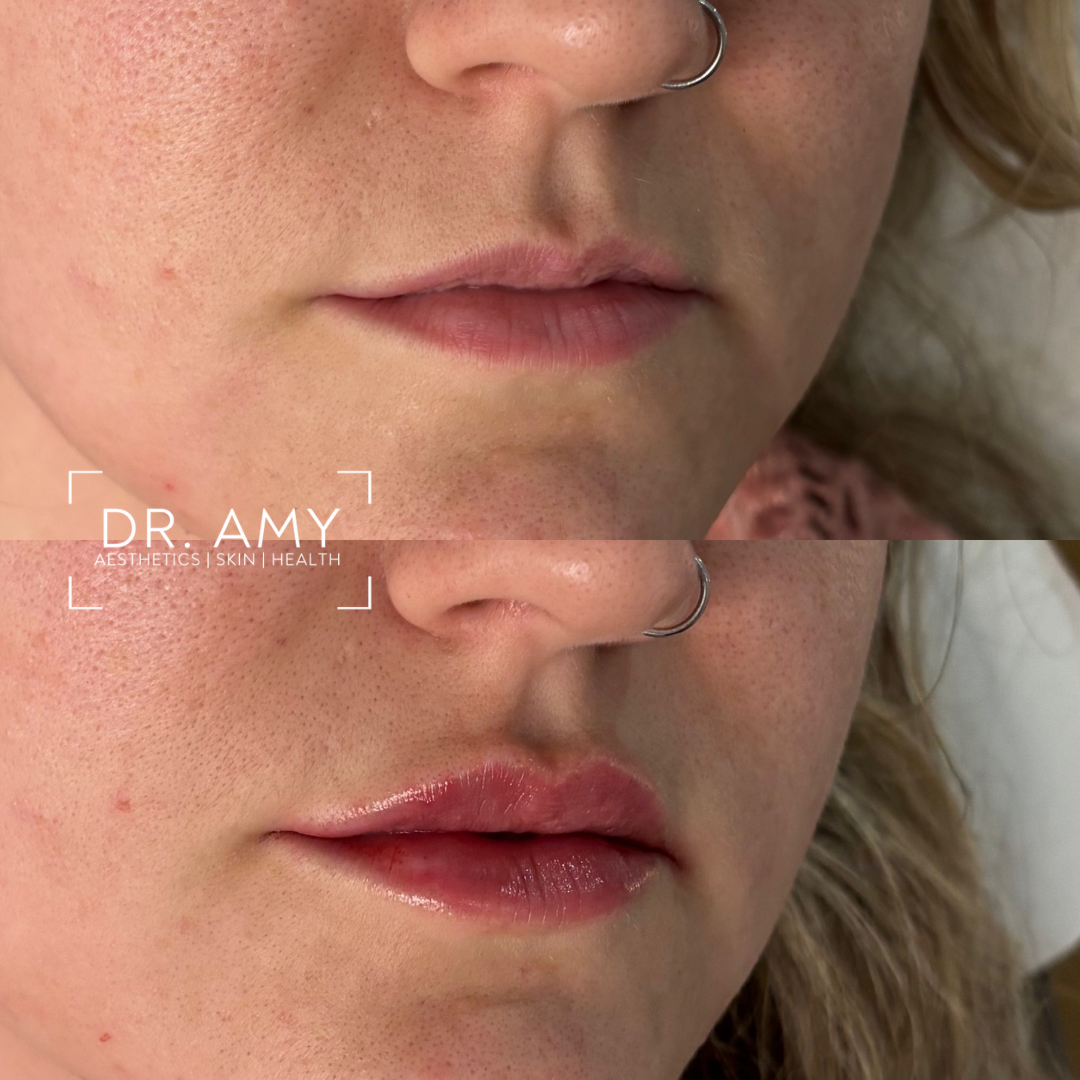 Dr Amy Aesthetics — photo 2