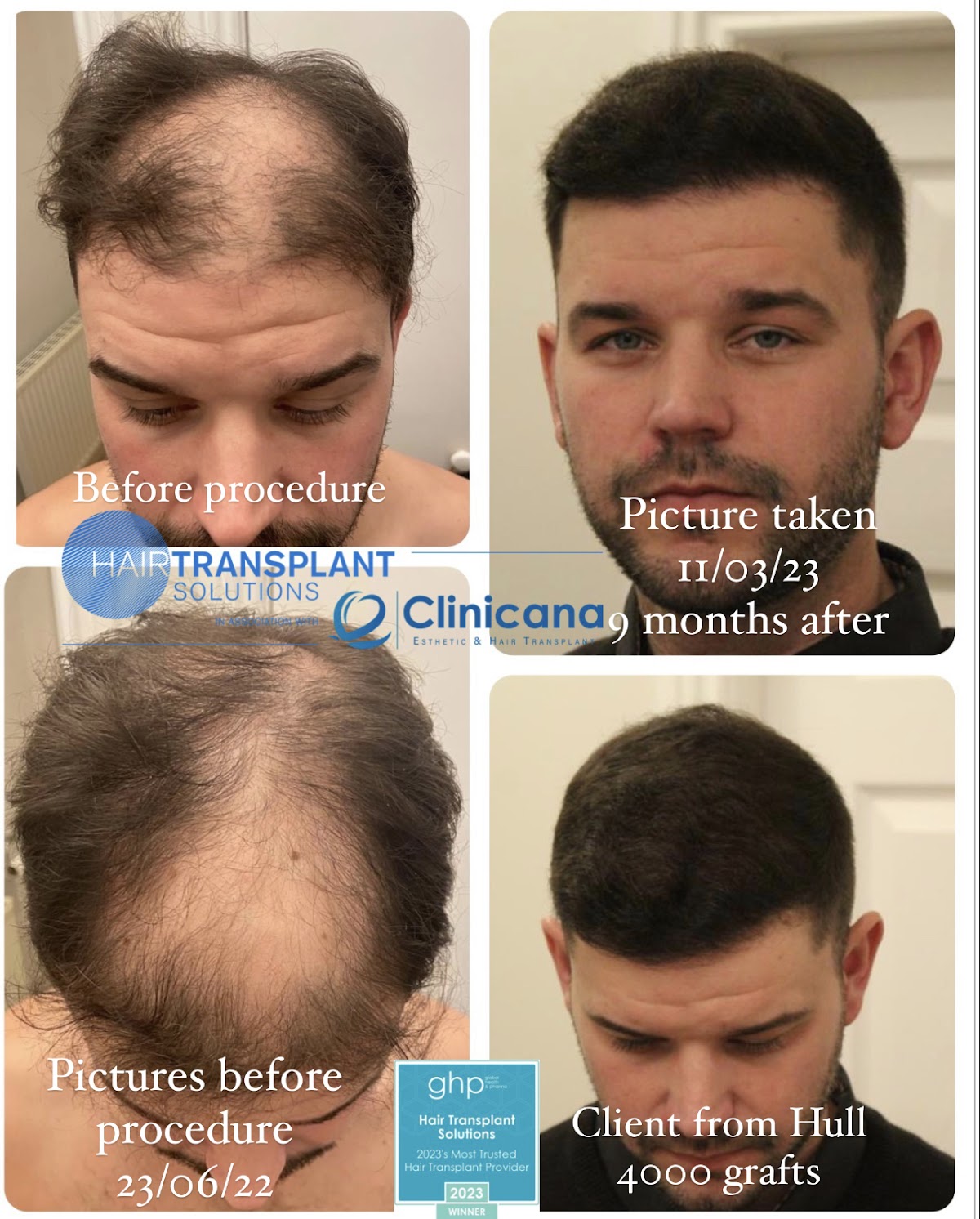 Hair Transplant Solutions — photo 5