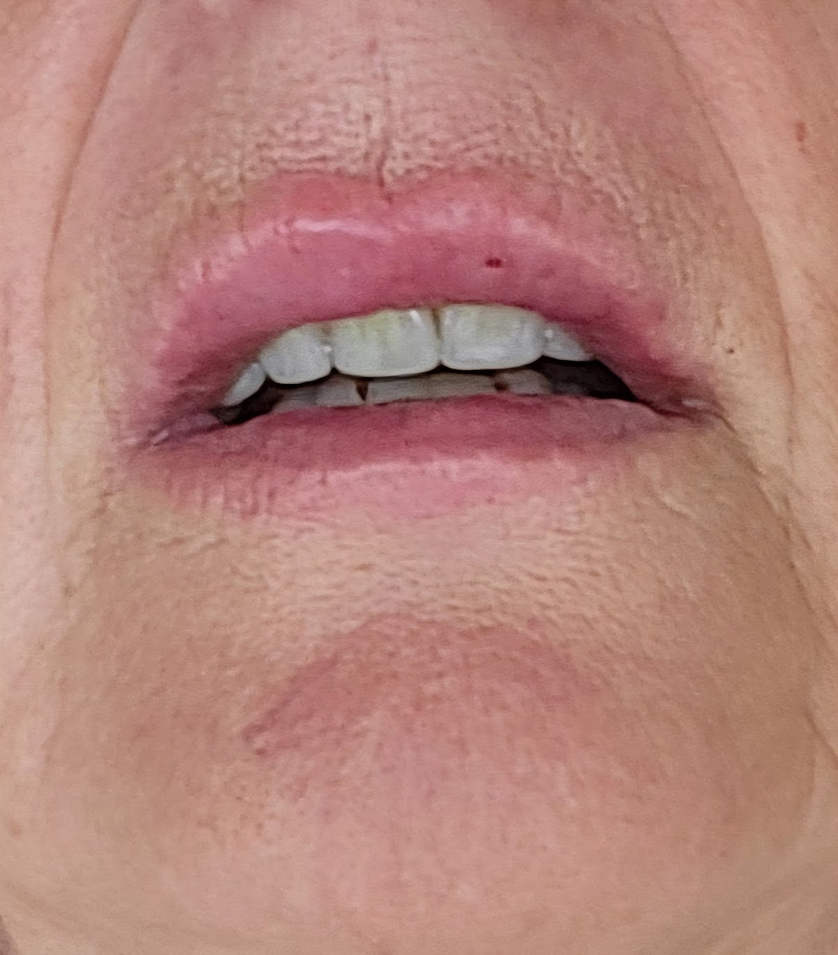 CCB Aesthetics-Medical Aesthetics|Banbridge Co. Down|Antiwrinkle injections|Lip and Dermal fillers|Weightloss|Skin|Wellness — photo 5