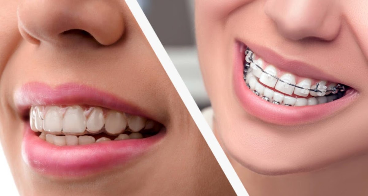 Bossier Family Dental Care | Dental | Bossier City, LA