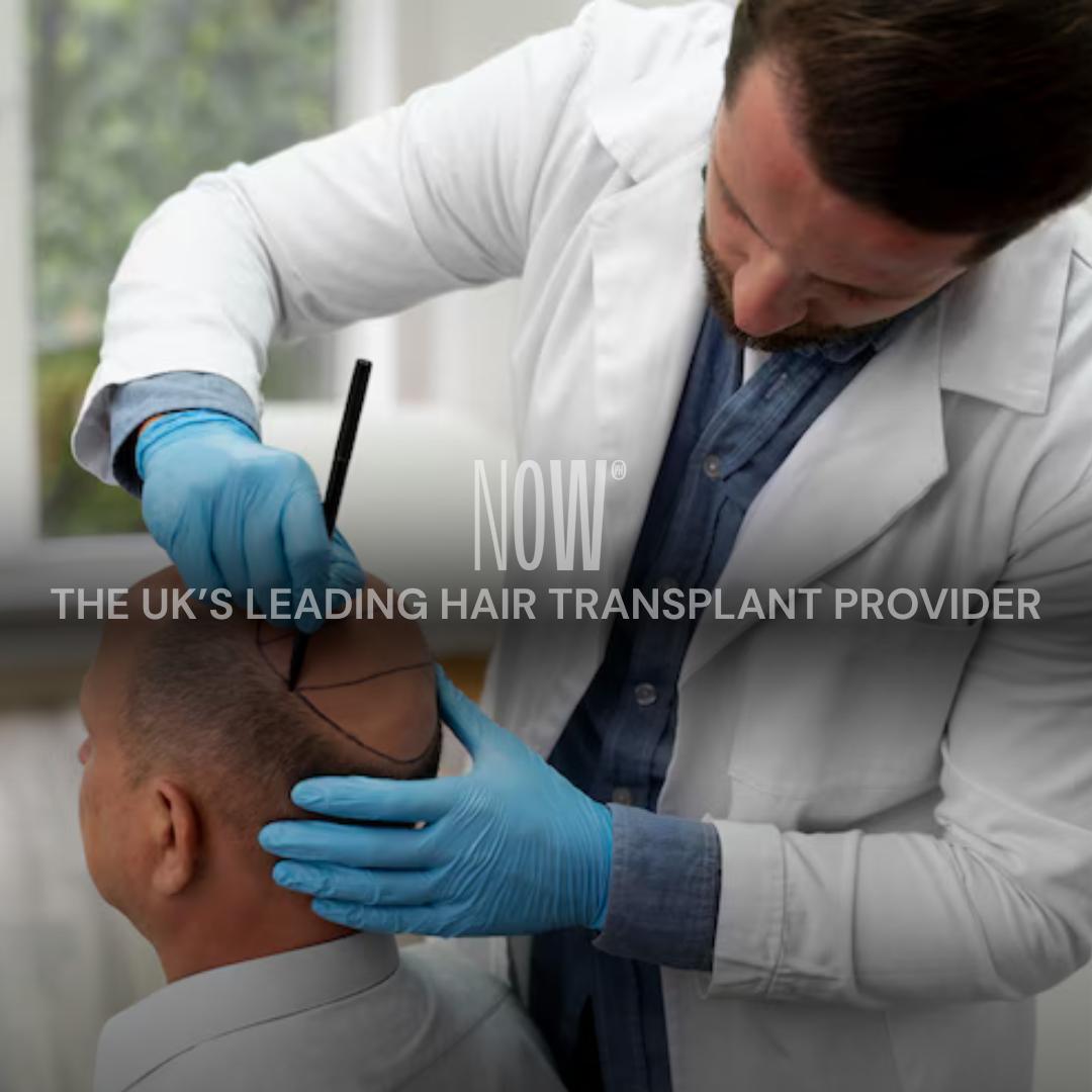 Now Hair by Now Cosmetic Surgery Ltd - Hair Transplant clinic in Doncaster, United Kingdom