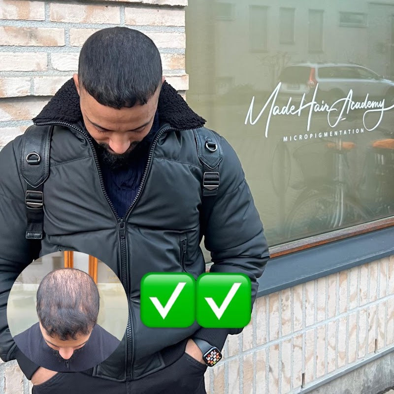 Made Hair Academy Stockholm Scalp Micropigmentation | Hair Transplant | 113 24 Stockholm