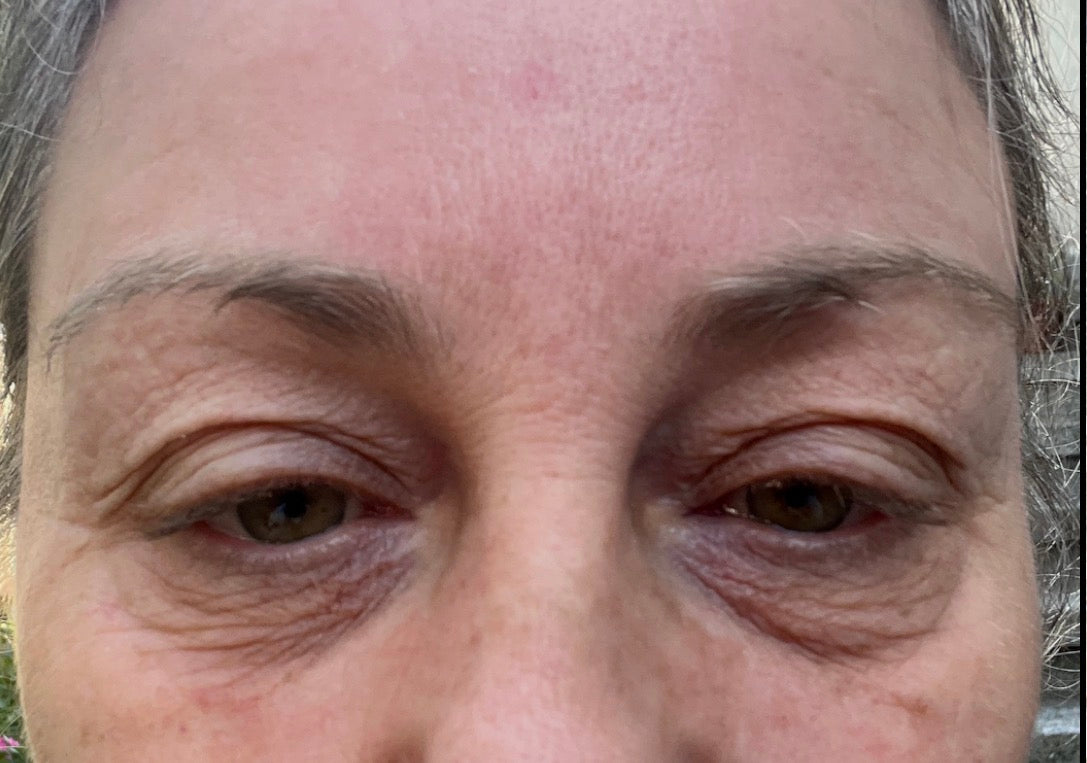 Dr. Emir Doğan / Laser Eye Surgery & Eyelid Aesthetic — Dr.Visor photo 4