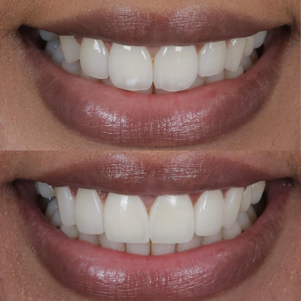 Cosmetic Smile Clinic - Birmingham Cosmetic Dentist — photo 4