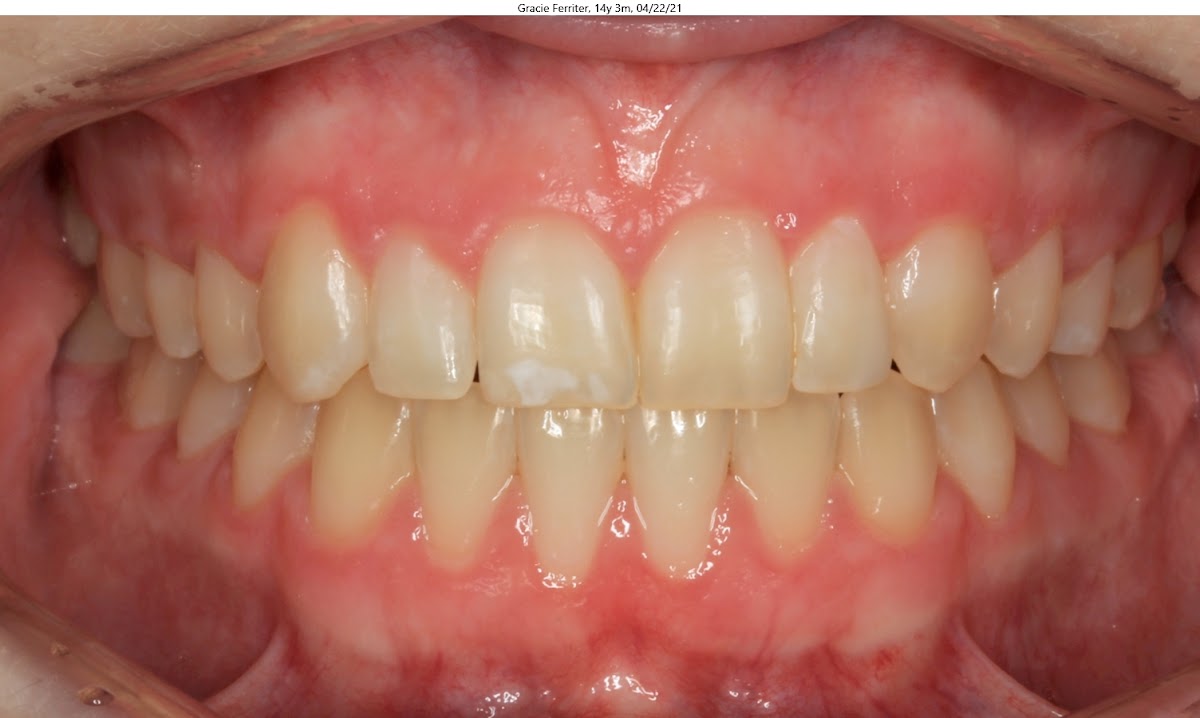 Elevation Dental | Dental | Butte, MT