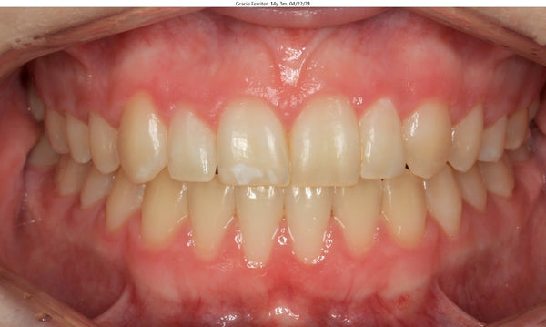 Elevation Dental | Dental | Butte, MT