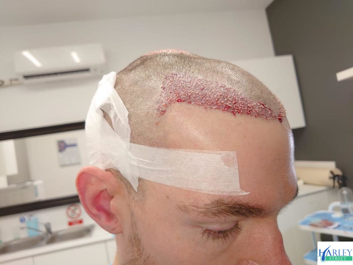 Manchester Hair Transplants Clinics — photo 4