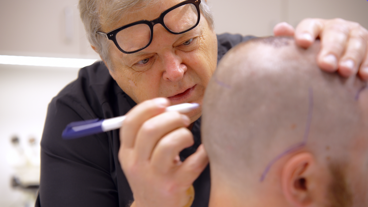 The Petrus Center for Aesthetic Surgery and Hair Transplantation | Hair Transplant | North Little Rock, AR