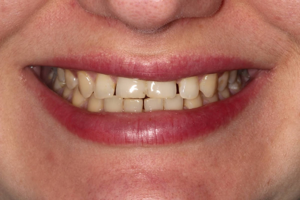 City Dental - Leeds — Dr.Visor photo 3