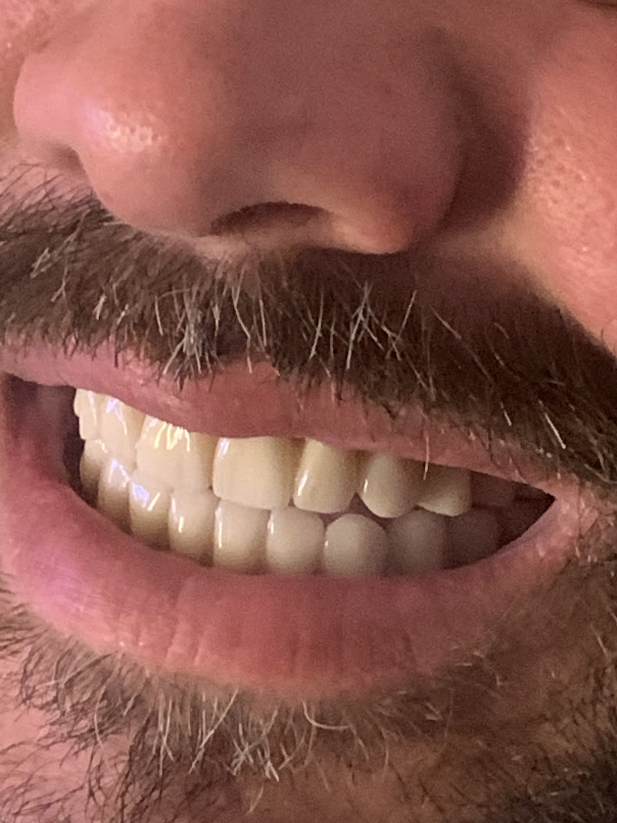 Anveli Dental Serbia - Dental clinic in Beograd, Serbia