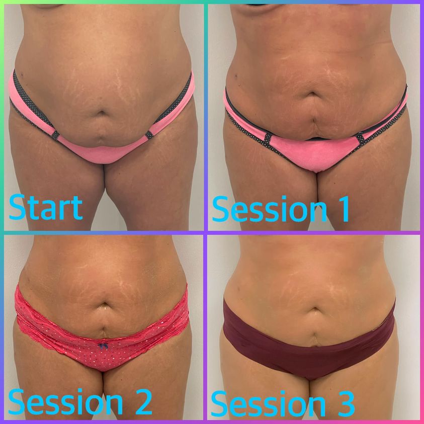 Art of Aesthetics | Aesthetic Surgery | Columbia, MO