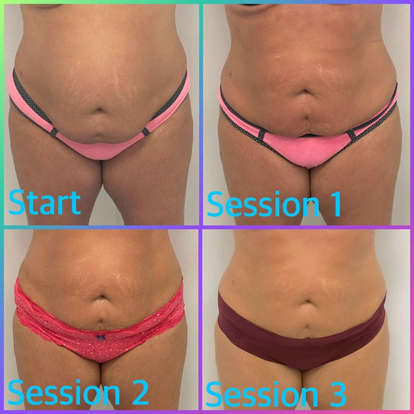 Art of Aesthetics | Aesthetic Surgery | Columbia, MO