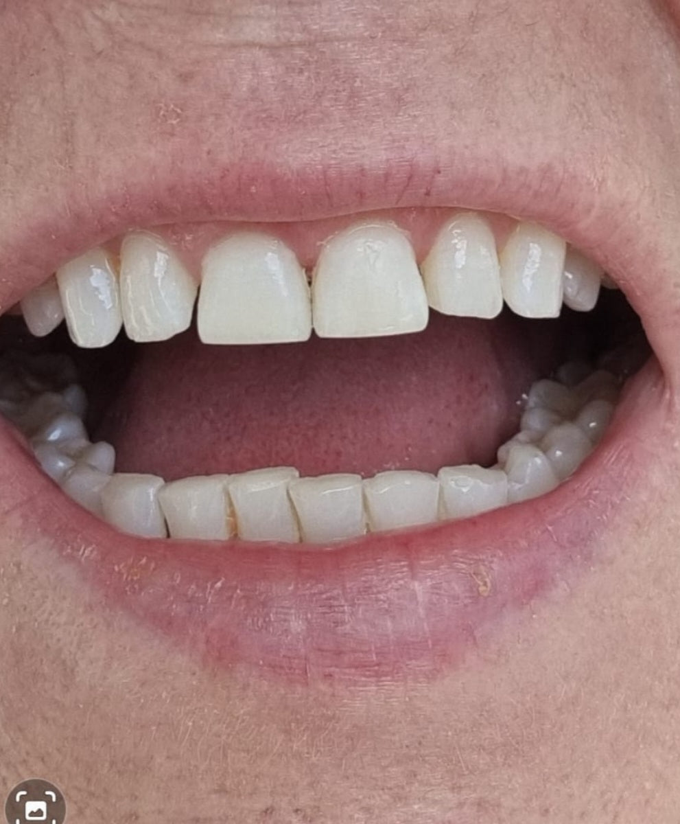 Acorn Dental - Moseley, Birmingham — photo 2