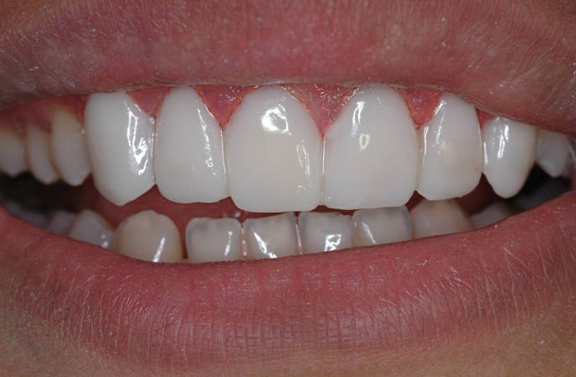 The Dental Implant Group — Dental Clinic in London