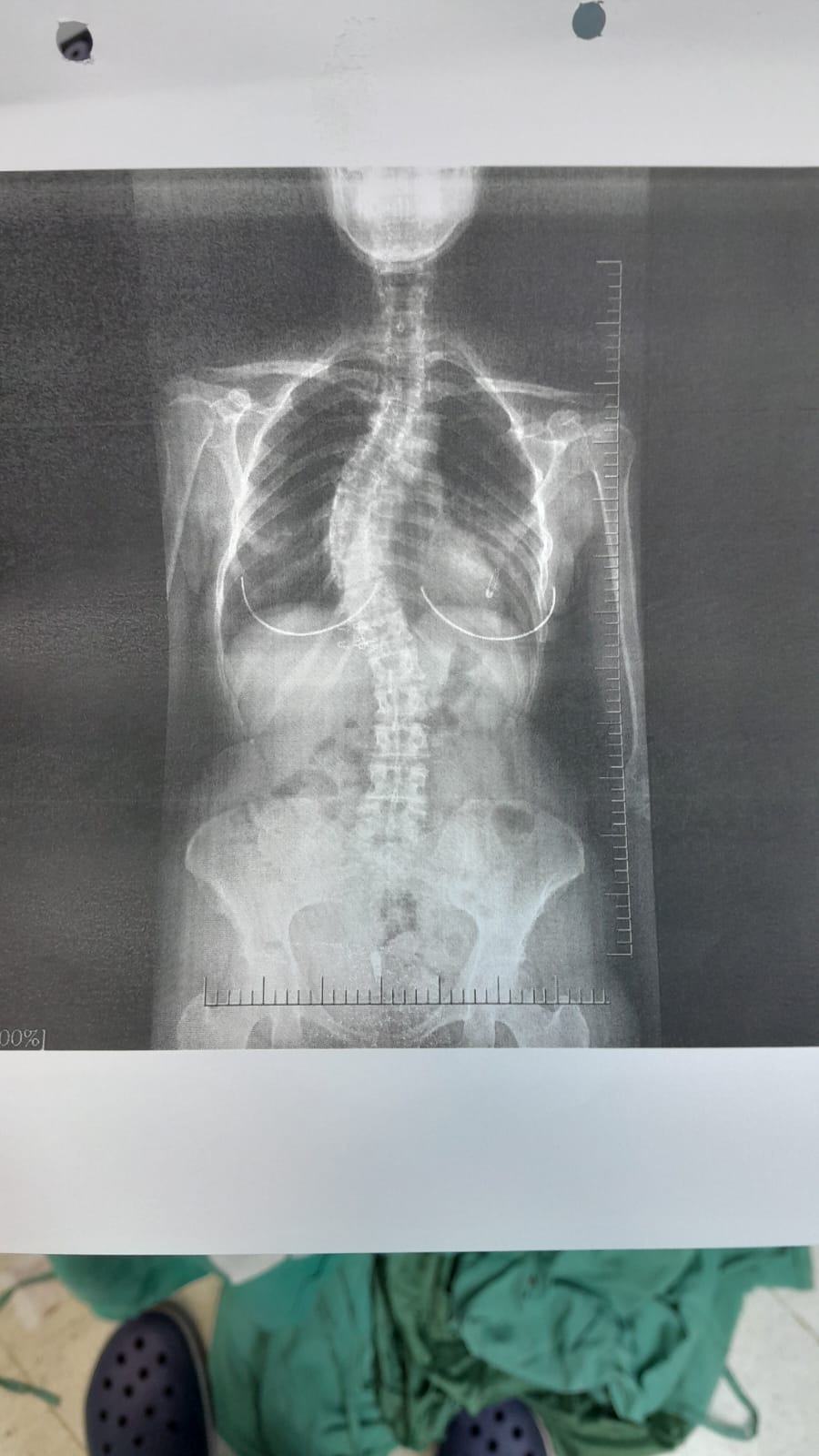 Prof. Dr. Tolga Ege, Omurga Cerrahisi — Dr.Visor photo 4
