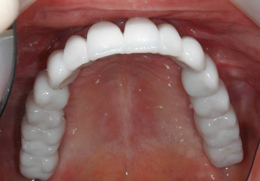 The Dental Implant Group — photo 5