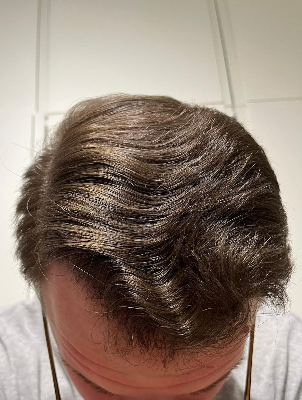 Erna Hair Clinic İzmir Saç Ekim Merkezi — Dr.Visor photo 5